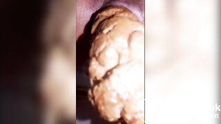 rectum à vider