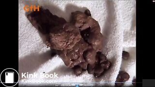 Serious Constipated Rocks