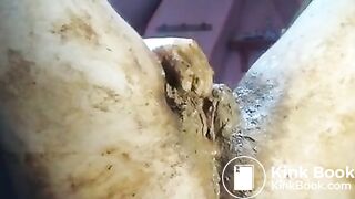 FtM scat packing and repacking, dirty anal prolapse