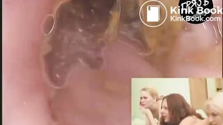 camera in the butthole