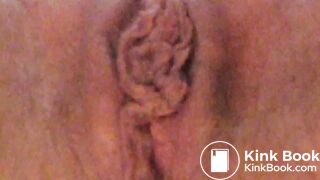 No Wonder She Has Hemorrhoids