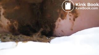 No Wonder She Has Hemorrhoids