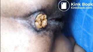 Hairy girl shitting an hard turd