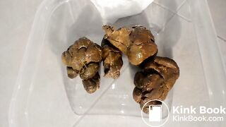 ça pousse au trou et ça pue