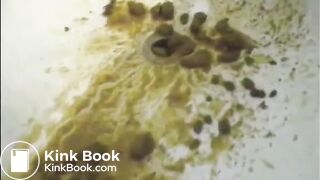Woman shitting a very liquid diarrhea