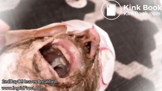 EXTREME  FORCED  FEEDING  !