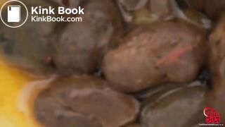 Worst case of constipation