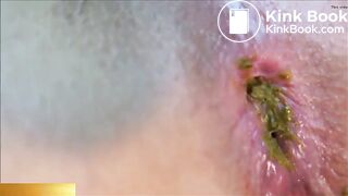 bord de chaise et gp