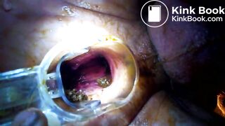 VID_20171229_041020