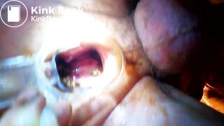 VID_20171229_041020