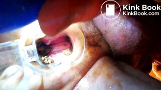 VID_20171229_041020