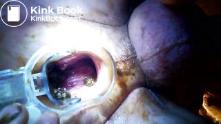 VID_20171229_041020