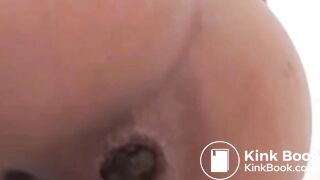 Närbild Anus