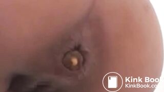 Närbild Anus
