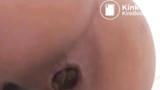 Närbild Anus