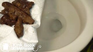 bel anus qui tarde à s'ouvrir