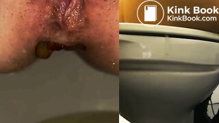 stall fight DOOKIE