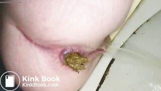 dookie hurts 1