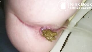 dookie hurts 1