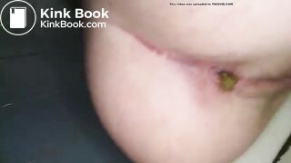 dookie hurts 1