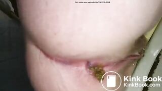 dookie hurts 1
