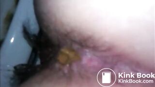 Hairy woman shitting closeup on a dirty toilet