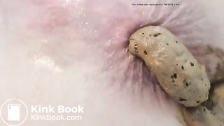 au bord de l'anus