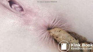 au bord de l'anus