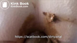 anal scat