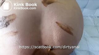 anal scat