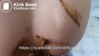 anal scat