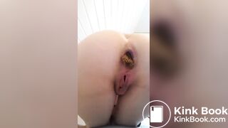caca haut 2
