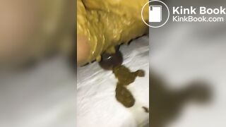 super shitty fisting