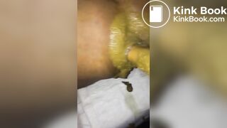 super shitty fisting