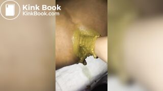 super shitty fisting