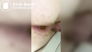 me Having a Shit