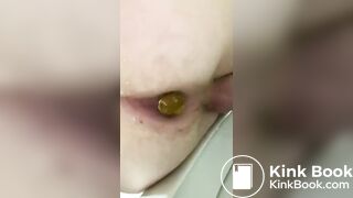 me Having a Shit