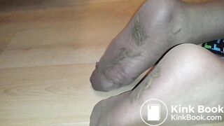 After two weeks Dead Maggots Feet