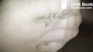 Look the Maggots eating my Toes