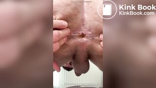 Scottish Alpha Shitting