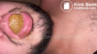 Toilet Flushes My Turds And Spit