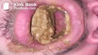 Shit Beast Eats My Full Dump