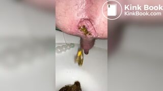 i shit