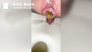 i shit