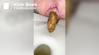 i shit