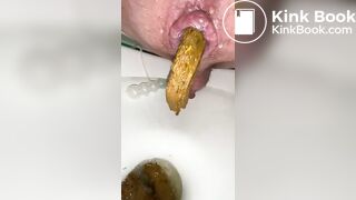 i shit