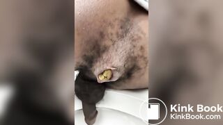 The Male Defecation Process