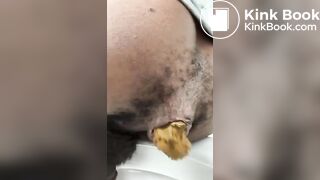 The Male Defecation Process