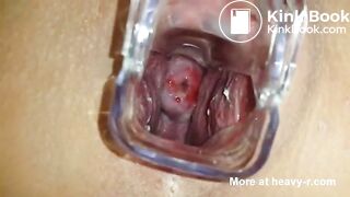 Stuffing Pussy with Shit