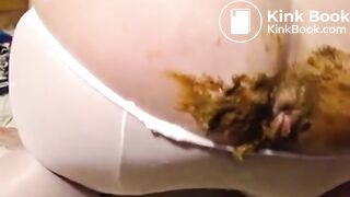 Fat Mature shits with Prolapse